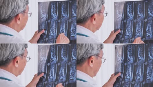 亚洲资深男医生正在深入分析x光片的治疗效果。高清在线视频素材下载