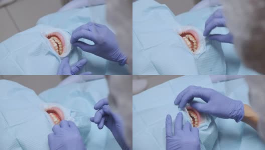特写的牙医的手在蓝色手套治疗妇女的牙齿戴保护在牙科诊所。保健和医学的概念。高清在线视频素材下载