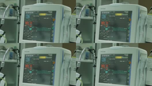 手术室患者心电图监测高清在线视频素材下载