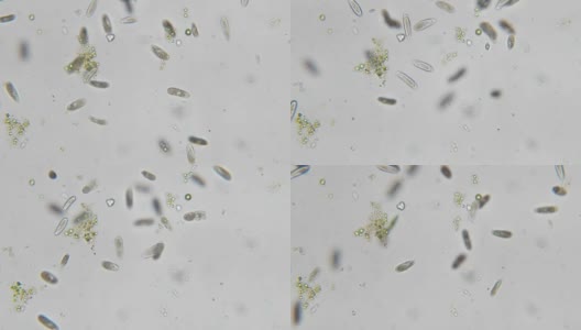四膜虫是显微镜下的单细胞纤毛原生动物和细菌属高清在线视频素材下载