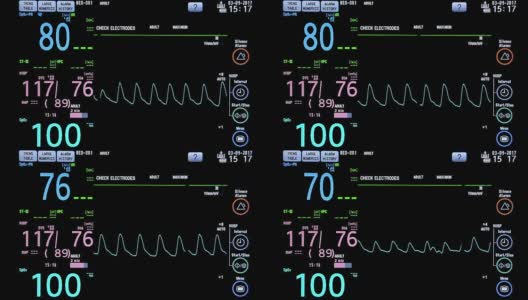手术室心脏监护仪的关闭。心电监护仪显示患者的心率背景高清在线视频素材下载