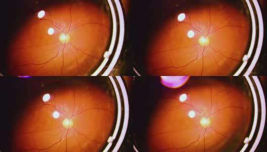 人眼虹膜收缩高清在线视频素材下载