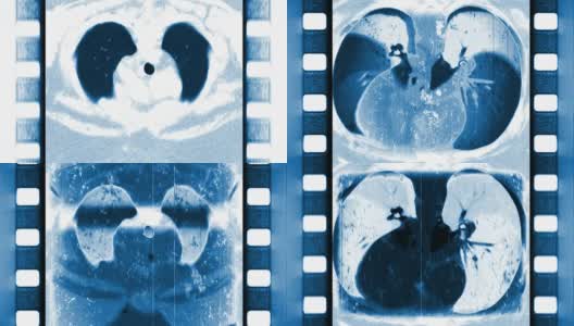 医用扫描x射线胶片卷轴高清在线视频素材下载