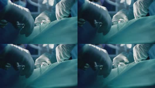 手术成功后，专业外科医生缝合伤口的双手特写。背景中的现代医院手术室。高清在线视频素材下载