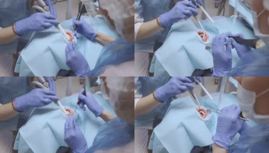 牙科医生的手戴着蓝手套，在牙科诊所里治疗戴着保护装置的妇女的牙齿。保健和医学的概念。高清在线视频素材下载