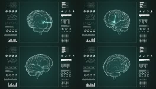 医用超高清抽象动画。实验室仪表板界面。人脑在诊断电脑显示器上的研究。高清在线视频素材下载