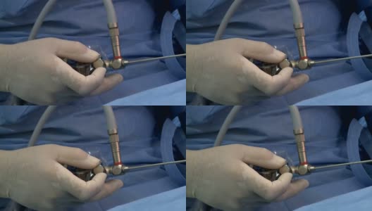 在手术室里做手术高清在线视频素材下载