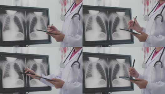 亚洲女性医生的手使用数字平板分析x射线图像高清在线视频素材下载