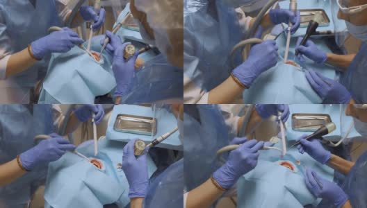 一个年轻的女人的特写镜头两个牙医在蓝色的手套治疗一个女人的牙齿戴保护在牙科办公室。保健和医学的概念。高清在线视频素材下载