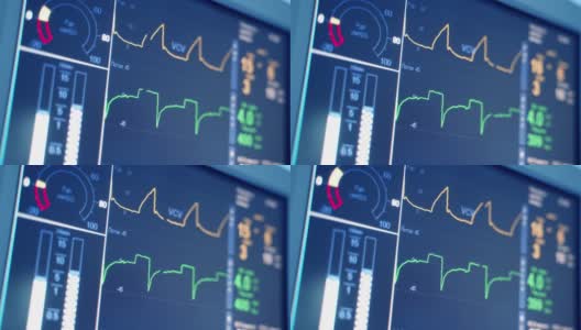 监测病人的生命体征，如心率。数字心脏监测器读出线图形和数字显示的病人被测量。特写镜头。高清在线视频素材下载