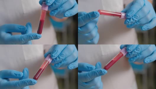 女实验室技术员戴着防护手套拿着移液管，在医院病房检测血液样本进行输血，双手要靠近。试管。血液采样、分析高清在线视频素材下载