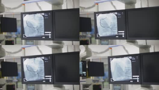 心脏手术期间放射学的监视器屏幕高清在线视频素材下载