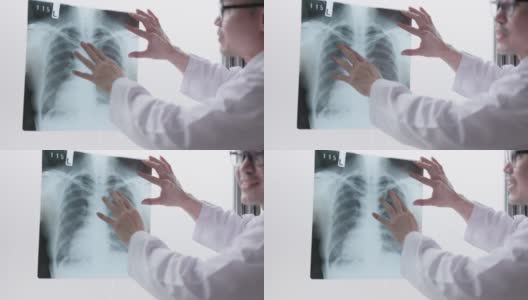 在医院的放射科，一名成熟的男医生和一名年轻的女病人正在检查胸部x光片和肺部扫描。高清在线视频素材下载