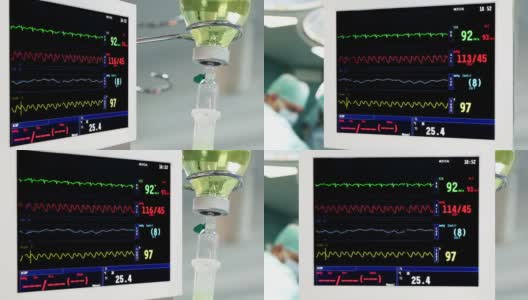 手术室旋转监护仪高清在线视频素材下载