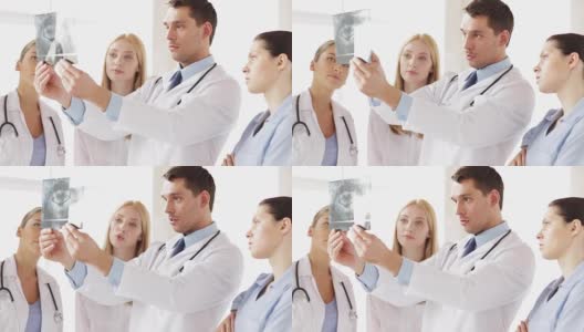一组医生正在讨论人类下颌x光扫描高清在线视频素材下载
