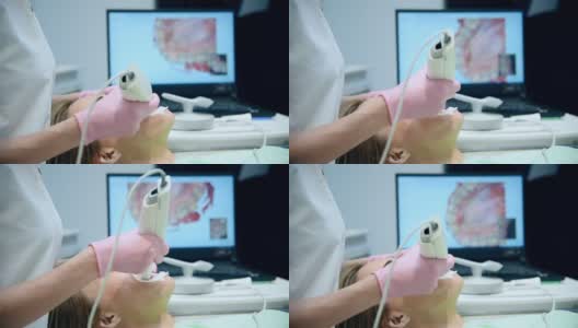 牙科医生用牙科三维扫描仪扫描病人的牙齿高清在线视频素材下载