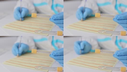 戴着医用手套的医生、护士或医疗技术人员手持试管进行血液检测，并为检测covid - 19和冠状病毒的患者填写表格。DNA PCR检测方案高清在线视频素材下载