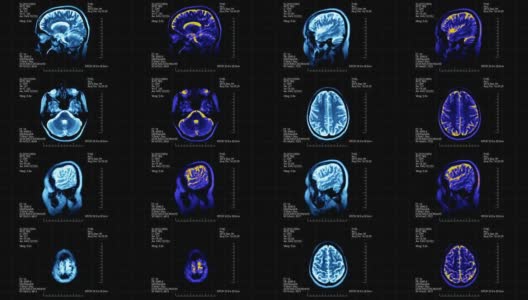 核磁共振脑部扫描未来显示四幅图片蓝色和蓝绿色在黑色的背景高清在线视频素材下载
