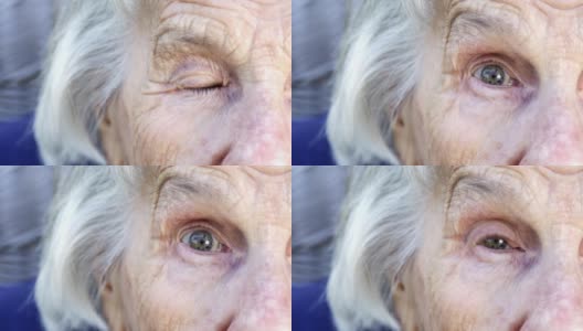 大眼睛美丽，尖锐，聪明的老年白人妇女独特的斑点漂亮的眼睛和脸在夏天的户外高清在线视频素材下载