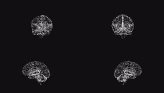 动画3d模型的人脑旋转在黑色背景和脉冲脑电波。高清在线视频素材下载