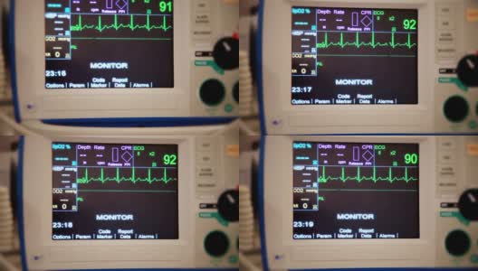 从患者心脏监护仪的角度拍摄的真实照片显示正常的窦性节律高清在线视频素材下载