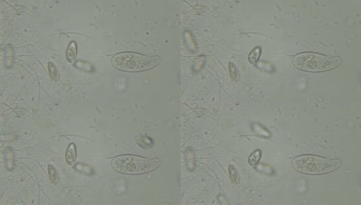 单细胞动物(滴虫)在显微镜下的运动。在湖水中显微镜下观察的纤毛虫柱头藻群落。关闭了。UHD 4 k高清在线视频素材下载