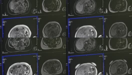 MRI脑部断层扫描专业医疗设备。高清在线视频素材下载