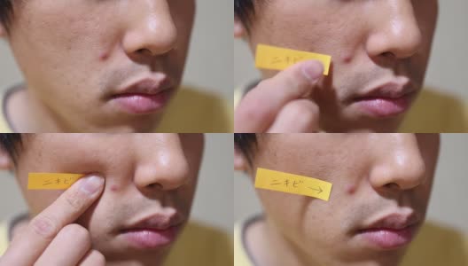 一个日本男人脸上的粉刺高清在线视频素材下载