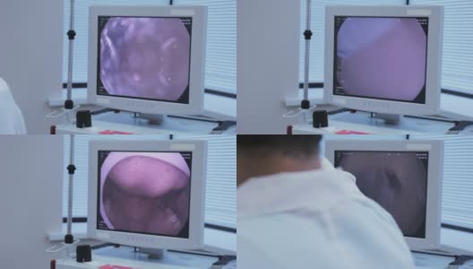 监控内窥镜，医生将他的相机胃镜通过病人的嘴贴在病人身上高清在线视频素材下载