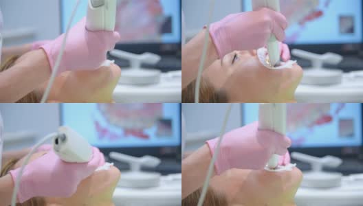 牙科医生用三维扫描仪扫描病人的牙齿。高清在线视频素材下载