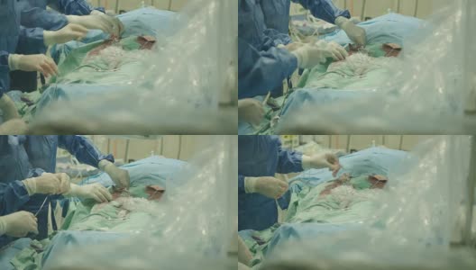在医院的外科病房里，正在进行心导管插入术的医生们高清在线视频素材下载