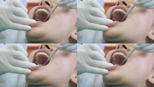牙科病人在牙科诊所检查牙齿的妇女。UHD高清在线视频素材下载