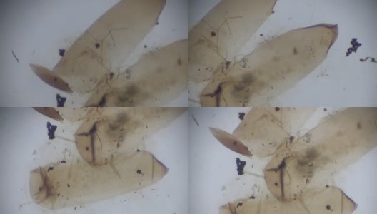 光显微镜下的库蚊卵高清在线视频素材下载