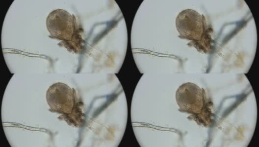 在显微镜下观察，死尘螨成了微生物的栖息地高清在线视频素材下载