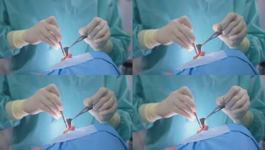鼻外科手术鼻子的外科手术。外科医生在给病人做鼻部手术时使用无菌手术器械。特写镜头。高清在线视频素材下载