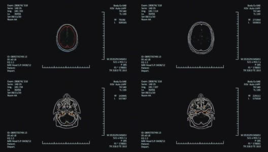 未来的放射学检查高清在线视频素材下载