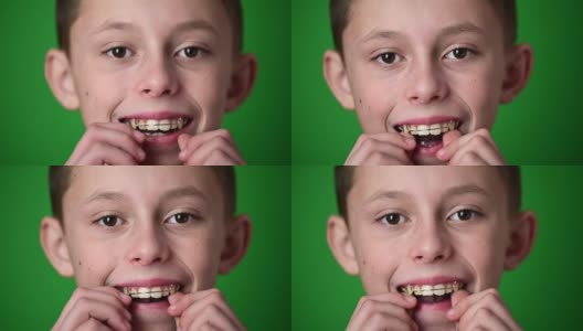 孩子戴上牙齿矫正板，绿色背景上是孩子的肖像。高清在线视频素材下载