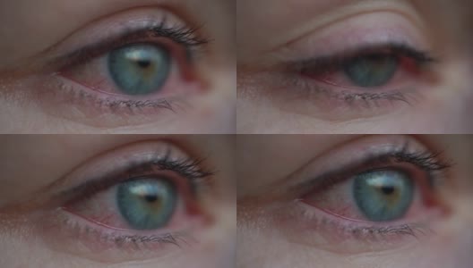 女孩有过敏干红眼睛或过敏。女性患发红。高清在线视频素材下载