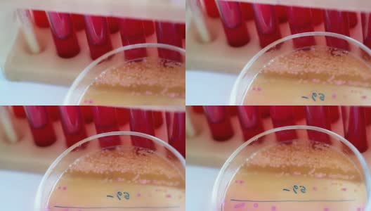 科学实验室。培养皿中的细菌菌落高清在线视频素材下载