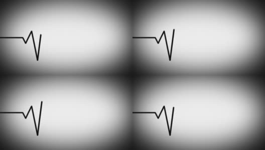 心电图(EKG或ECG)环路黑白相间高清在线视频素材下载
