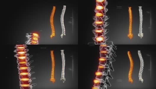 人体脊柱医学扫描高清在线视频素材下载