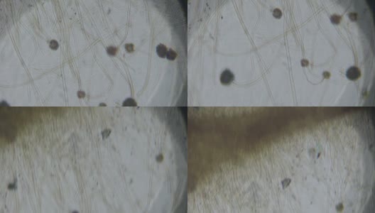 曲霉属真菌在显微镜下高清在线视频素材下载