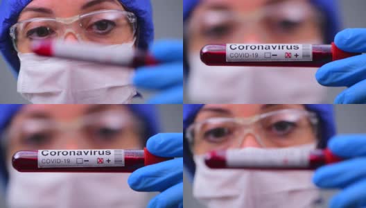 新型冠状病毒暴发疫情检测试剂盒检测冠状病毒COVID - 19医学样本高清在线视频素材下载
