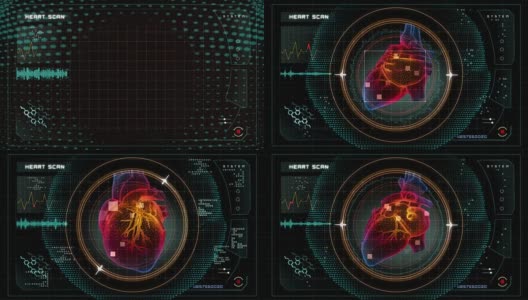 心脏扫描数据接口高清在线视频素材下载