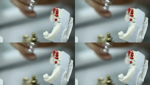 在石膏颌上放置牙桥高清在线视频素材下载