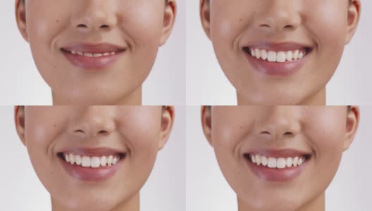 近距离拍摄的女性微笑广泛的相机，显示完美的白牙齿，慢动作。口腔卫生的概念高清在线视频素材下载