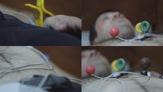 有个男人正在做心电图用的是吸引式心电图电极。高清在线视频素材下载