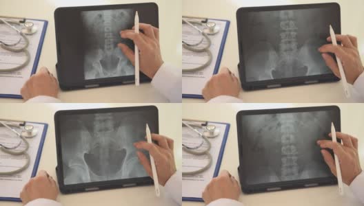 脊椎腰椎x线扫描高清在线视频素材下载