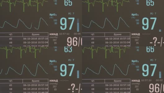 术中心律不齐的心电图和脉搏图像。高清在线视频素材下载