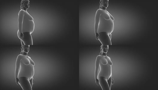 肥胖灰色概念-从肥胖到苗条高清在线视频素材下载